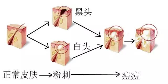 ABUIABACGAAg_Jj92gUo0JrehwIwgAU4wAI.jpg